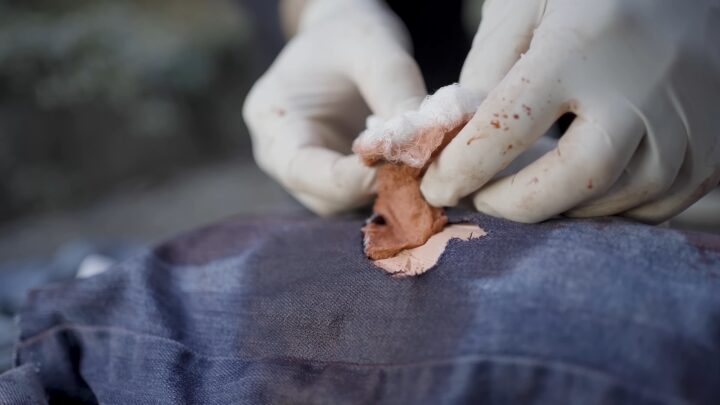 A Person Wearing Gloves Is Applying a Bandage to A Bleeding Wound on Someone's Leg